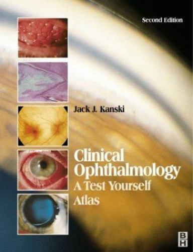 Clinical ophthalmology test - a,