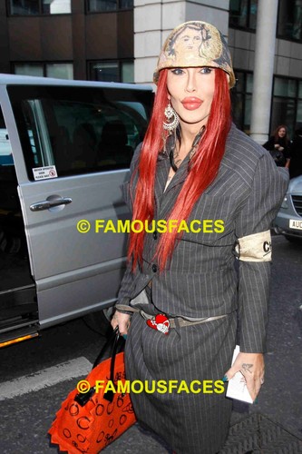 Pete burns dead alive - burns,