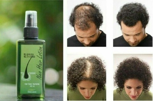 Neo hair lotion natural - neo,