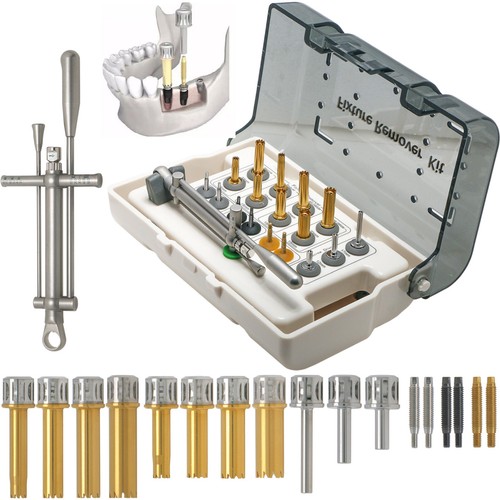 Implant fixture remover - implant,