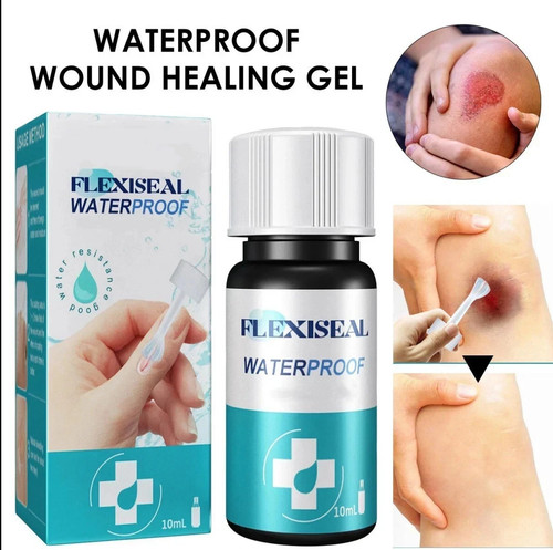 New body skin glue - body,