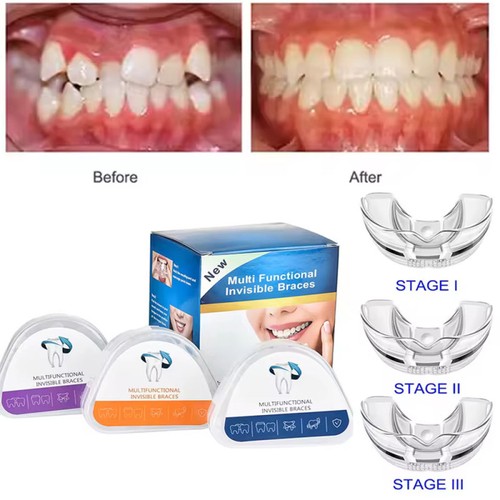 Stage straighten tool - 3,