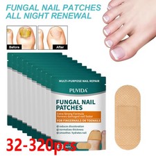 32-320Pcs Toe Nail Fungal Repair Sticker Patch Ingrown Toenail Correction Care