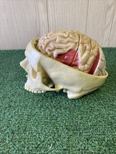 GPI 2900 Brain Model & Partial