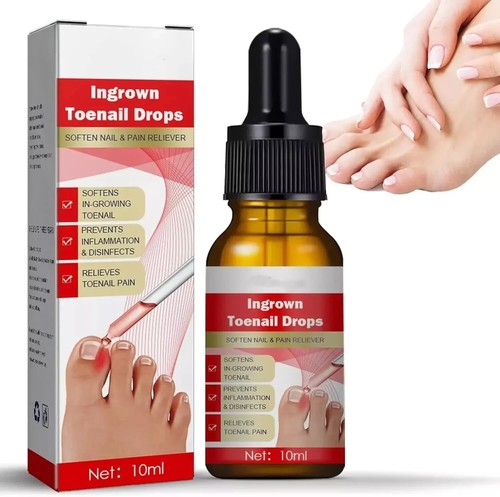 Ingrown toenail treatment drop - toenail,