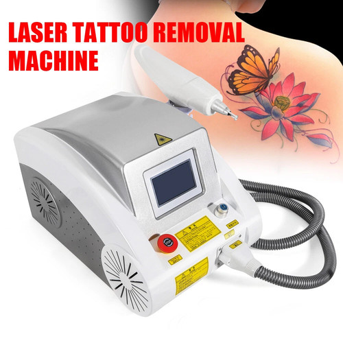 Yag switch tattoo - yag,