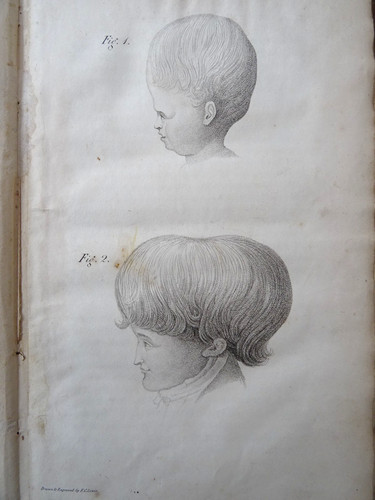 1825 phrenology doctrine - phrenology,