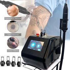 Picosecond Laser Tattoo