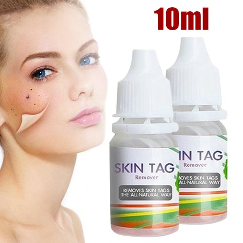 Skin tag remover - 10ml, mole