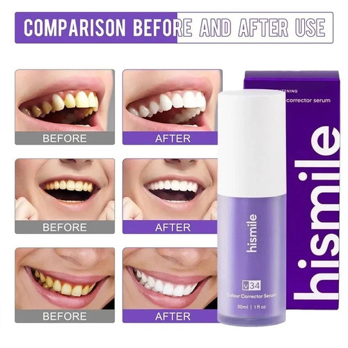 Hismile v34 colour corrector - colour,