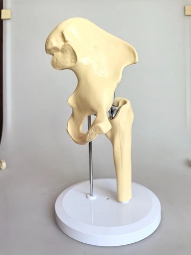 Artificial size hip - artificial,