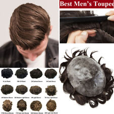 Mens Hair Replacement System