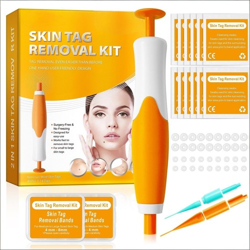 Skin tag removal kit with - skin,