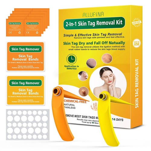 New skin tag - skin, remover