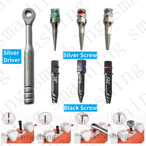 Broken implant fixture - broken,