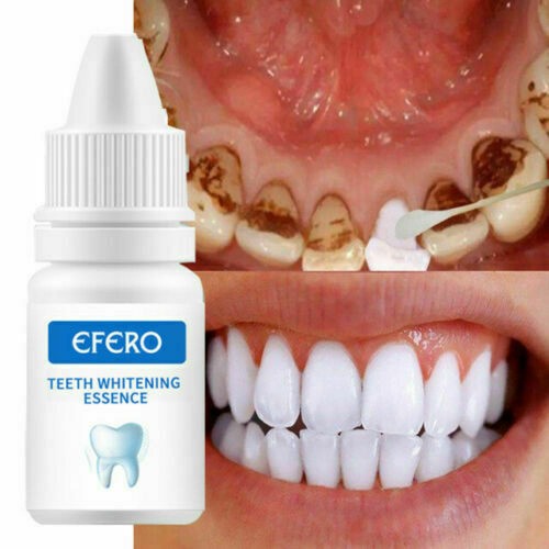 Teeth whitening serum gel - serum, oral
