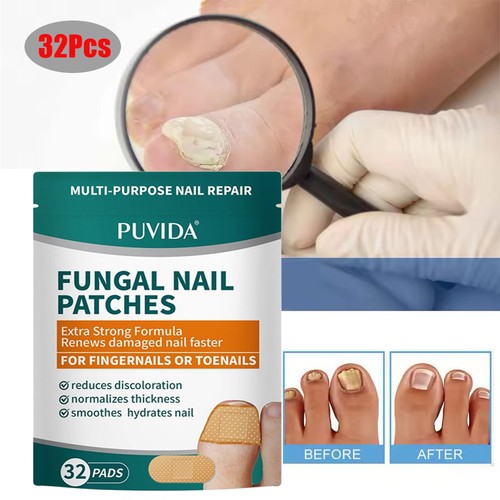 320pcs fungal nail - fungal,
