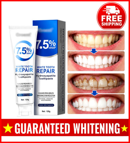 Best teeth whitening