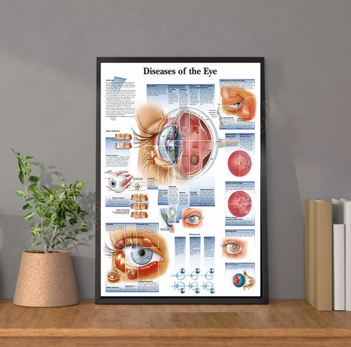 Diseases the eye - -, of