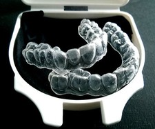 Teeth Whitening / Bleaching