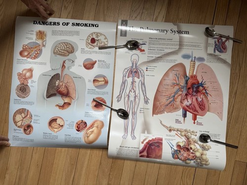 Medical posters pulmonary - posters,