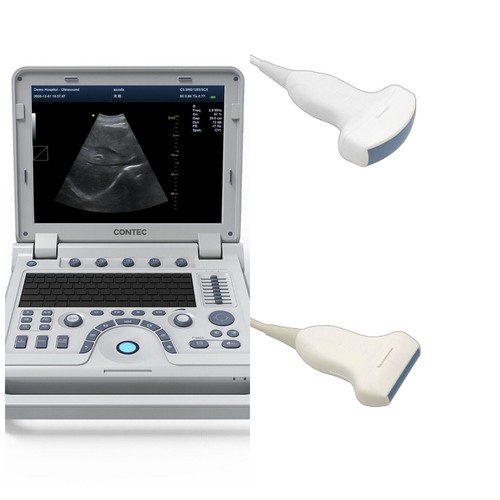 Contec cms1700a color doppler - contec,