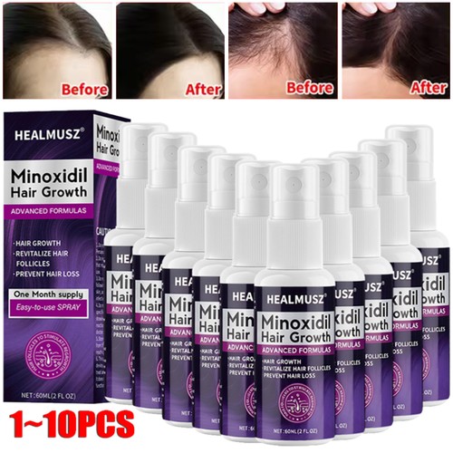 Minoxidil extra strength - extra,