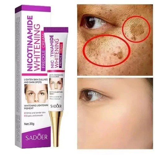2pcs whitening freckle cream - whitening,