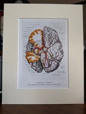Anatomical  Brain Print