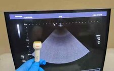 toshiba PST 65AT ultrasound Ultrasonic transducer probe transductor transduktor