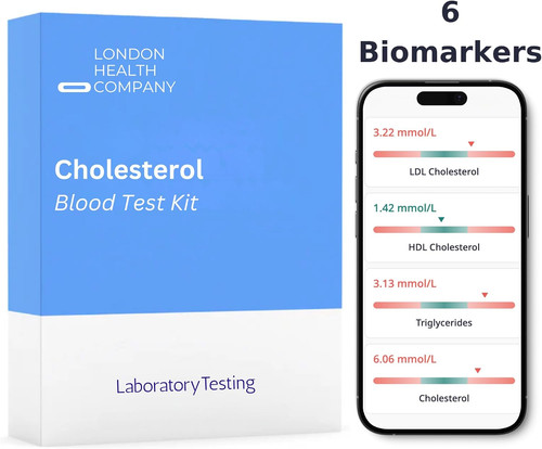 Total cholesterol - total,
