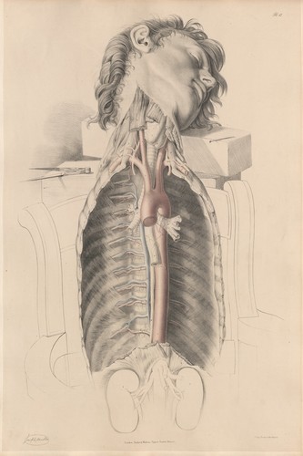 Anatomical dissection art - anatomical,