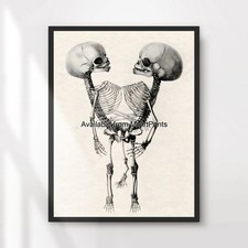 Siamese Twins Skeleton Creepy
