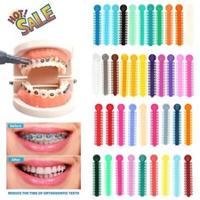1040pcs dental orthodontic - 1040pcs,