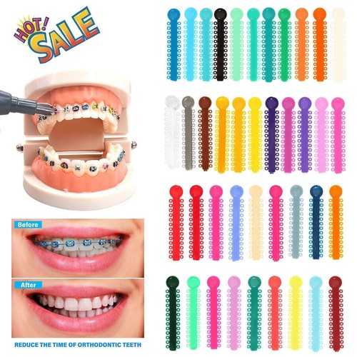 1040pcs dental orthodontic - 1040pcs,