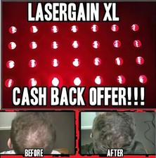 Laser Comb Hair Growth Loss