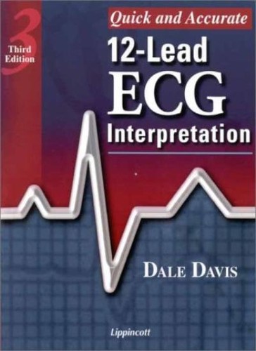 Quick and accurate lead ecg - and,