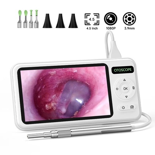 Inch screen digital - digital, otoscope