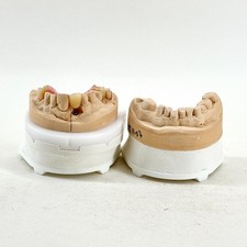 VINTAGE DENTAL CAST TEETH MODEL ANATOMICAL PROSTHETIC STUDY DISPLAY TEACHING