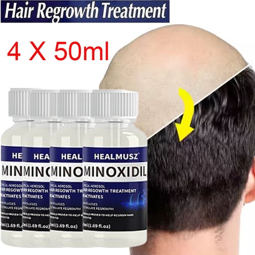 Minoxidil hair regrowth - minoxidil, 5%