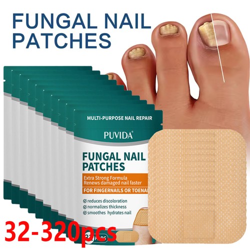 Anti fungal nail repair - anti-fungal,