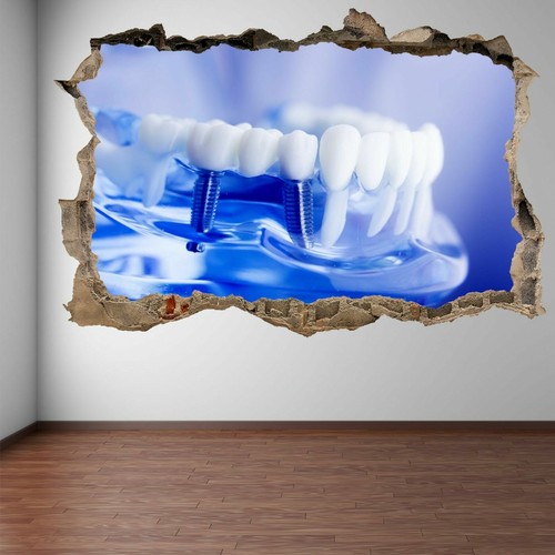 Implant tooth dental care - dental, wall