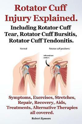 Rotator cuff injury explained - cuff,