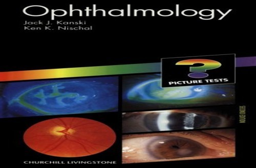 Picture tests ophthalmology - tests, in