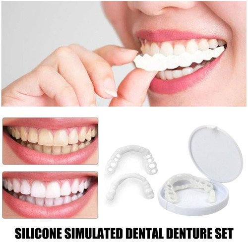 Snap false teeth upper - on,