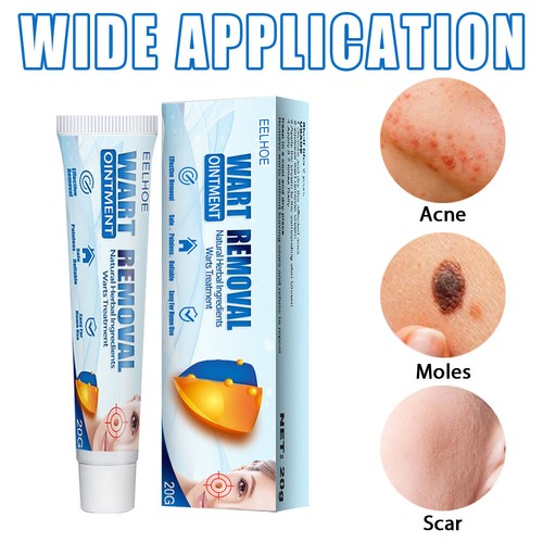 Skin tag removal warts - skin,