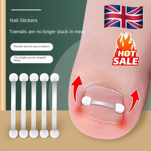 Toenail fixer - toenail,