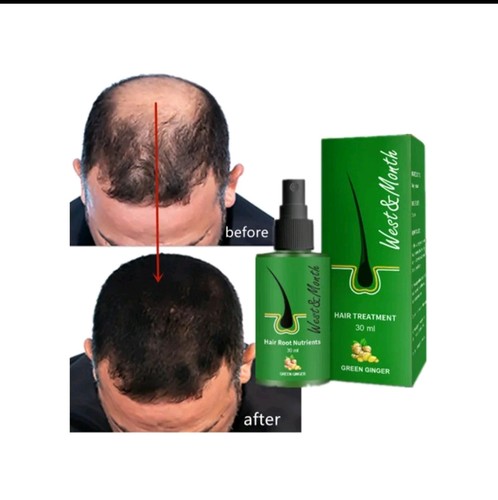 Neo hair lotion 120ml - hair,