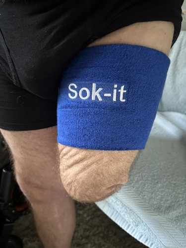 Above knee amputee socket - above,