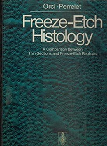 Freeze etch histology - freeze-etch,